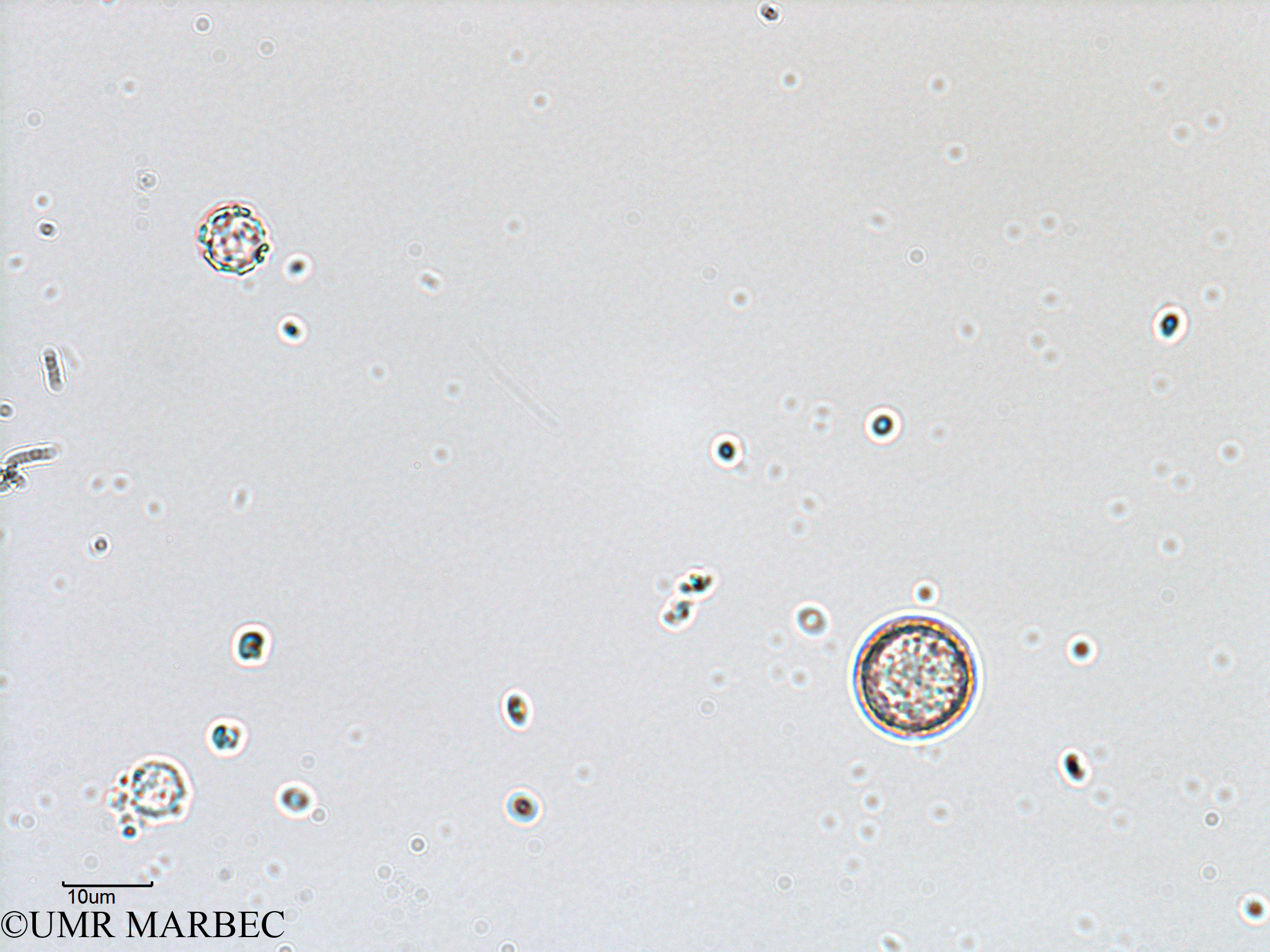 phyto/Bizerte/bizerte_bay/RISCO February 2015/Centrique spp 15-70µm (ancien Baie_T5-C2-Coccolitho spp-3).tif(copy).jpg